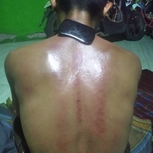 Terapi Guasha img 20250731 wa0051